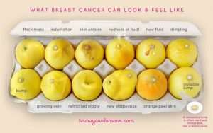 lemons - breast cancer